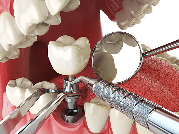 Best Tooth Infection Emergency Dentist  in Red Bluff, CA