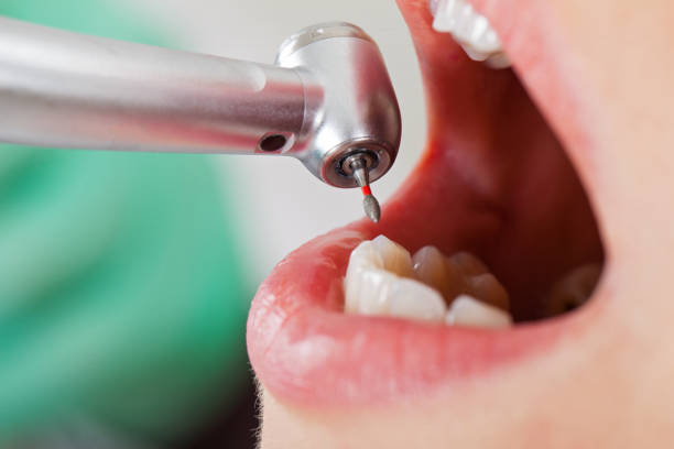Best Broken Tooth Emergency  in Red Bluff, CA